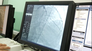 A poco más de un año de su inauguración, ya se realizaron más de 1000 procedimientos de Hemodinamia en el HCP
